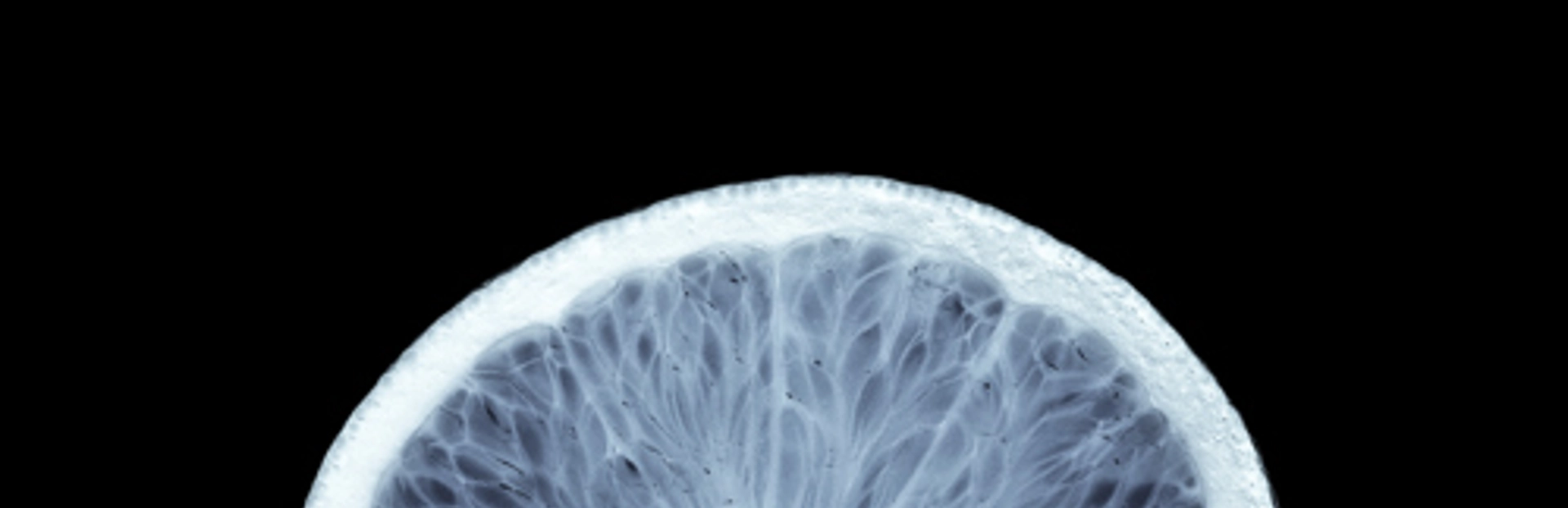 Xray Header V2 Bright Tall